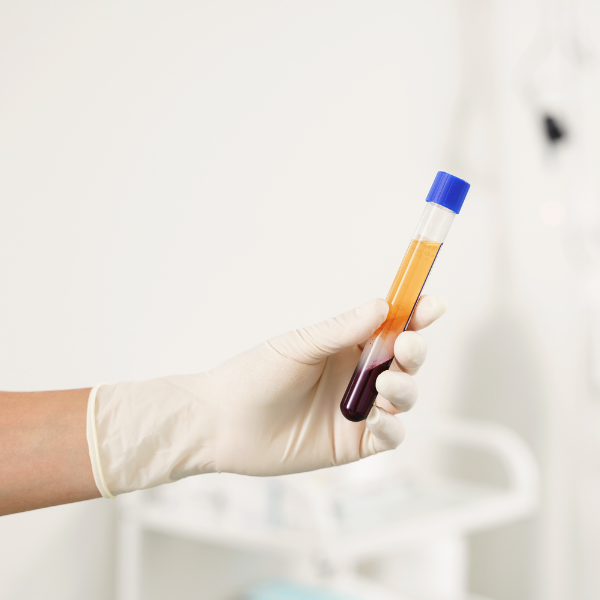 Uso de plasma rico en factores de crecimiento en Córdoba