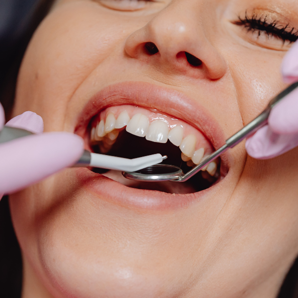 Equipo de Clínica Dental Olmo aplicando sedación consciente